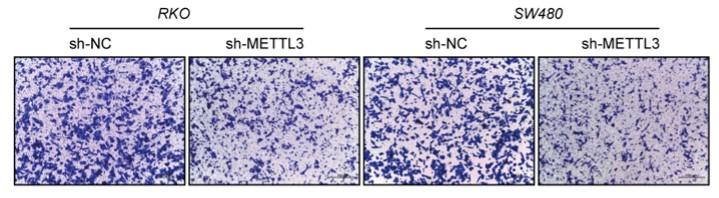 Decreased expression of METTL3 restrained CRC cell invasion ability.jpg